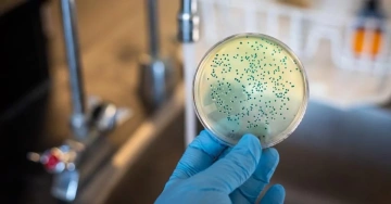Teste Microbiota intestinal – Drª Letícia Jacob